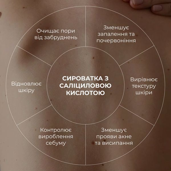 Комплект для боротьби з акне на тілі з саліциловою кислотою Hillary Salicylic Body Acne Treatment Set K2-11-093 фото