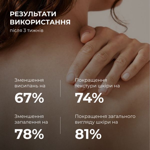 Комплект для боротьби з акне на тілі з саліциловою кислотою Hillary Salicylic Body Acne Treatment Set K2-11-093 фото