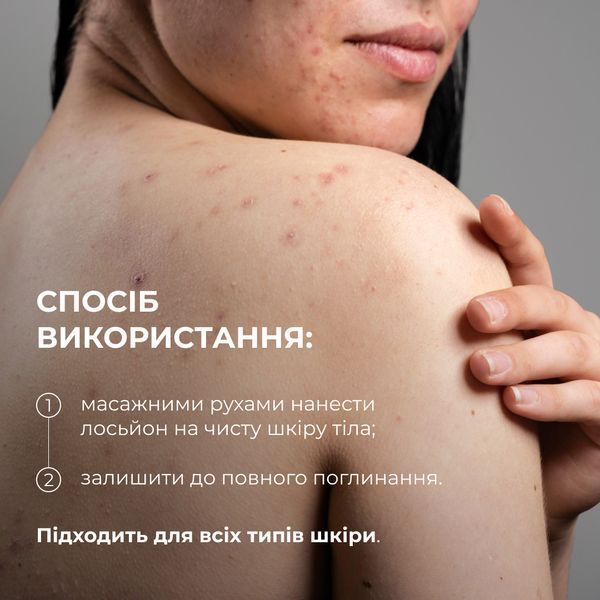 Hillary Лосьйон-детокс для проблемної шкіри з саліциловою кислотою Anti-Acne Salicylic Body Lotion, 150 мл HI-08-957 фото