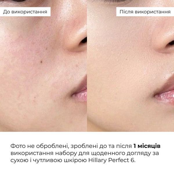 Набір для щоденного догляду за сухою і чутливою шкірою Hillary Perfect 6 M-11-623 фото